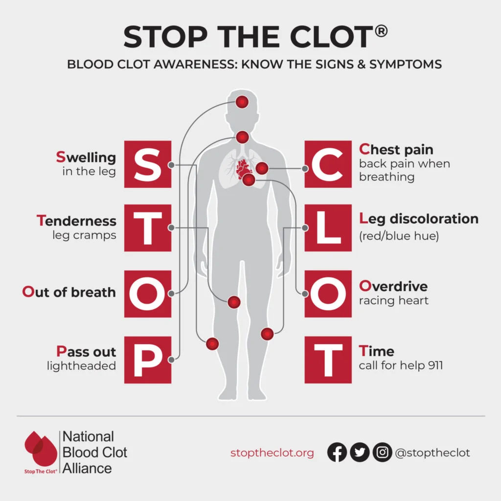 Blood Clot Symptoms