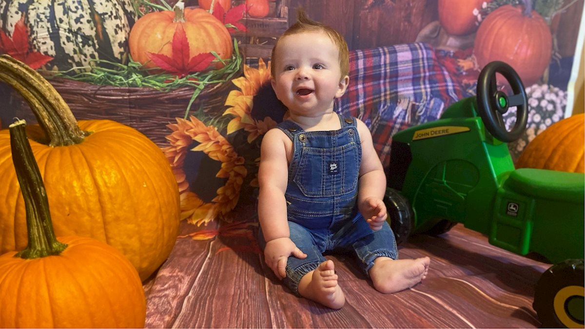Despite a rare defect and rocky beginning, Hampshire County baby is  thriving, happy | School of Medicine | West Virginia University