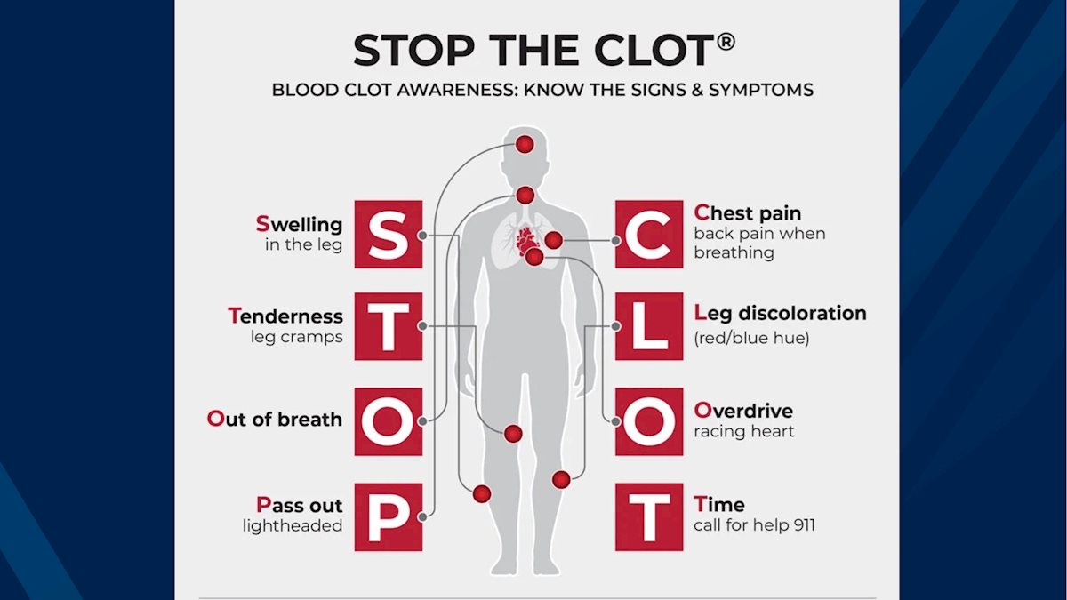 Knowing the symptoms of blood clots can be lifesaving
