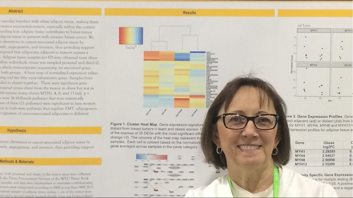 Mammary Fat of Lean and Obese Women with Breast Cancer