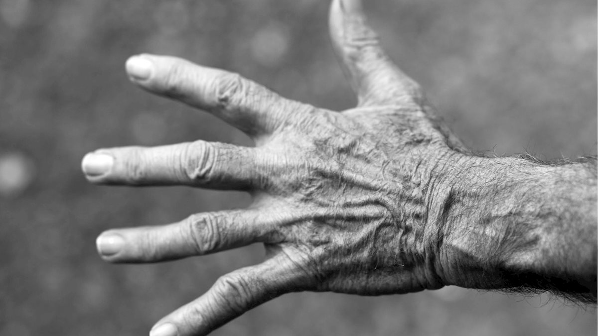 NIH grant aims to develop new drug to treat acute arthritis 