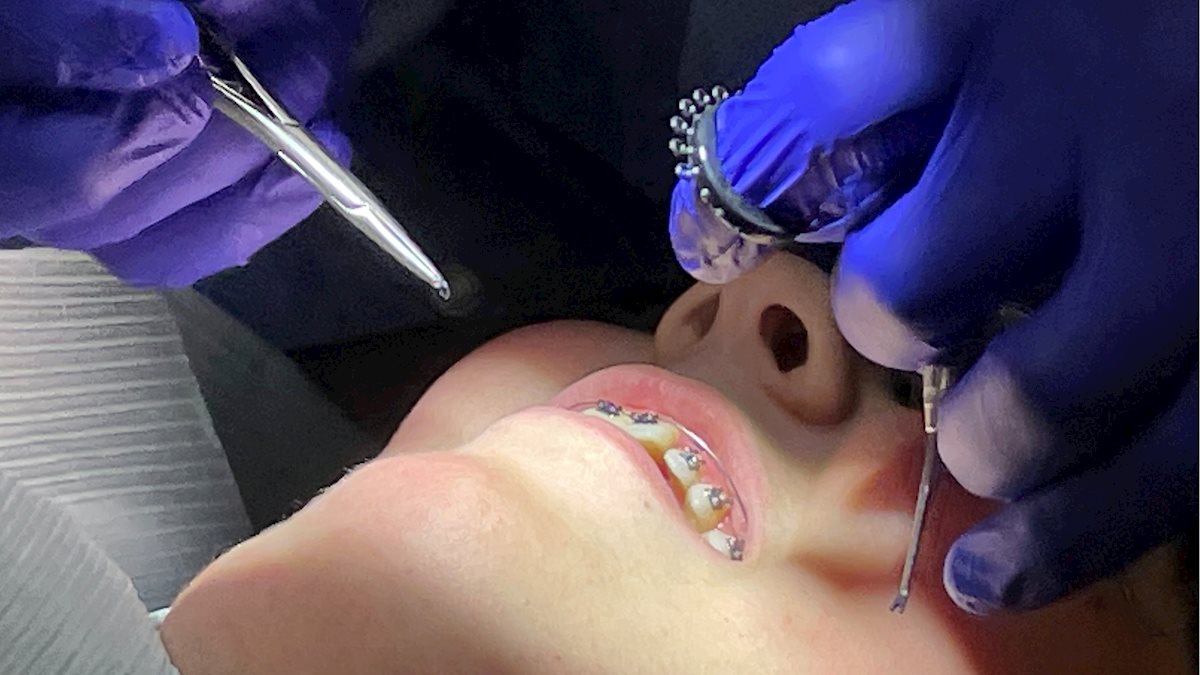 Orthodontics residents receive SAO grants