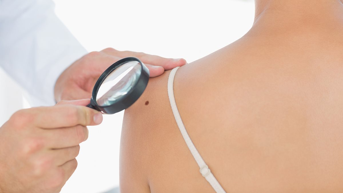 WVU Cancer Institute to offer free skin cancer screening