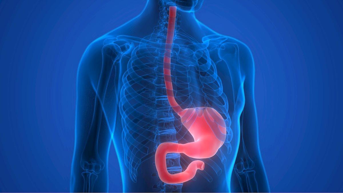 esophageal dysmotility