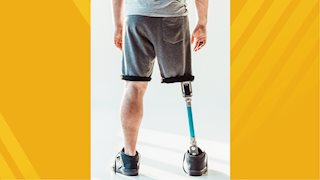 WVU Heart and Vascular Institute recognizes Limb Loss Awareness Month