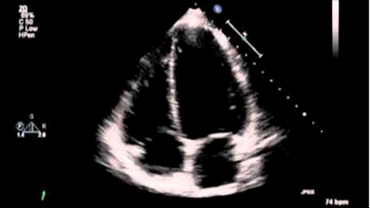 WVU Hospitals Adult Echocardiography Certificate Program receives accreditation