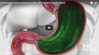 WVU Medicine Health Report - Esophageal Cancer Awareness Month