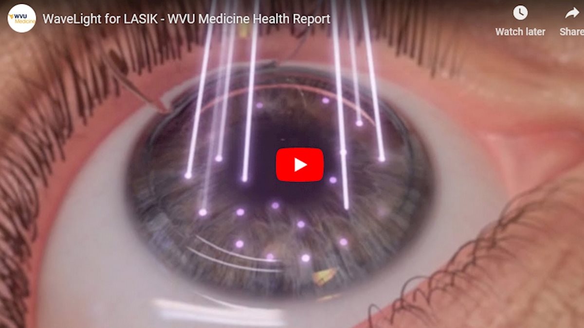 WVU Medicine Health Report: WaveLight for LASIK