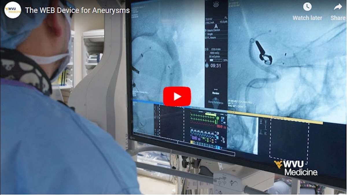 WVU Medicine Health Report: WEB device for treatment of aneurysms